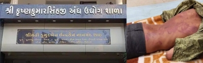 Gujarat: 2 blind school students suspended for beating classmates | Gujarat: 2 blind school students suspended for beating classmates