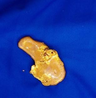 Man held at IGI airport with gold paste worth Rs 98 L | Man held at IGI airport with gold paste worth Rs 98 L