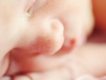 Probiotic products can be dangerous for preterm babies: US FDA | Probiotic products can be dangerous for preterm babies: US FDA Probiotic products can be dangerous for preterm babies: US FDA | Probiotic products can be dangerous for preterm babies: US FDA