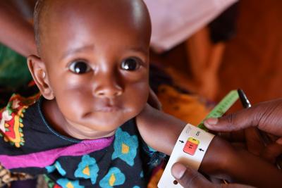 South Sudan declares measles outbreak | South Sudan declares measles outbreak