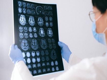 Upper heart chamber abnormalities lead to increased dementia risk: Study | Upper heart chamber abnormalities lead to increased dementia risk: Study
