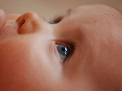 Higher risk of glaucoma suspected in infants undergoing cataract surgery, says study | Higher risk of glaucoma suspected in infants undergoing cataract surgery, says study Higher risk of glaucoma suspected in infants undergoing cataract surgery, says study | Higher risk of glaucoma suspected in infants undergoing cataract surgery, says study