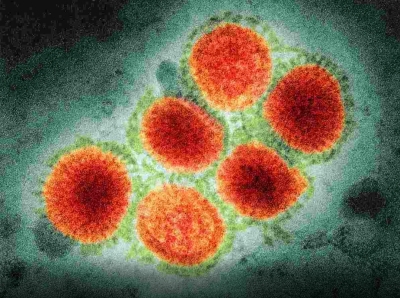 WHO reports first death from H3N8 virus in China | WHO reports first death from H3N8 virus in China