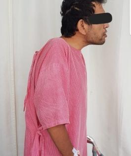 Man stands straight after 15 years, courtesy Hyderabad hospital | Man stands straight after 15 years, courtesy Hyderabad hospital