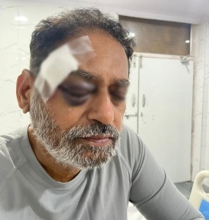 Pushed by cops, Maha Congress' Dr. Nitin Raut hurt in Bharat Jodo Yatra | Pushed by cops, Maha Congress' Dr. Nitin Raut hurt in Bharat Jodo Yatra