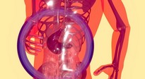 Fatty liver in pregnancy may increase risk of preterm birth | Fatty liver in pregnancy may increase risk of preterm birth Fatty liver in pregnancy may increase risk of preterm birth | Fatty liver in pregnancy may increase risk of preterm birth