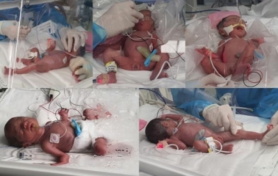 Quintuplets born for 1st time in 34 yrs in S.Korea | Quintuplets born for 1st time in 34 yrs in S.Korea