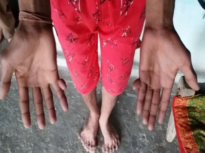 This MP family members have 12 fingers in hand and feet | This MP family members have 12 fingers in hand and feet
