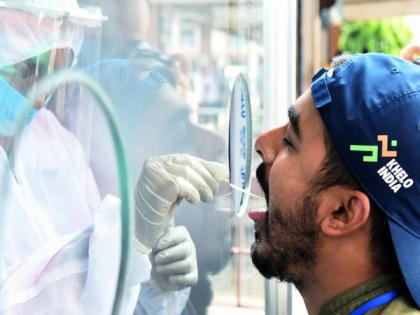India records 2,380 new COVID-19 cases in last 24 hours, daily positivity rate at 0.53 pc | India records 2,380 new COVID-19 cases in last 24 hours, daily positivity rate at 0.53 pc India records 2,380 new COVID-19 cases in last 24 hours, daily positivity rate at 0.53 pc | India records 2,380 new COVID-19 cases in last 24 hours, daily positivity rate at 0.53 pc