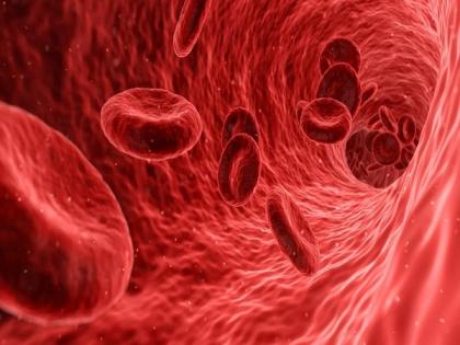 Novel study suggests iron deficiency can be managed better | Novel study suggests iron deficiency can be managed better Novel study suggests iron deficiency can be managed better | Novel study suggests iron deficiency can be managed better