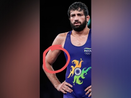 Tokyo Olympics: Nurislam Sanayev bites Ravi Dahiya during semi-final clash, Sehwag labels act 'disgraceful' | Tokyo Olympics: Nurislam Sanayev bites Ravi Dahiya during semi-final clash, Sehwag labels act 'disgraceful'