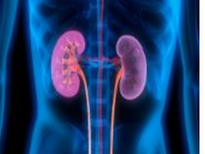Researchers analyze new drug combination to improve survival in advanced kidney cancer | Researchers analyze new drug combination to improve survival in advanced kidney cancer