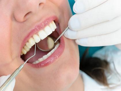 Here's how gum disease could lead to severe COVID-19 infection | Here's how gum disease could lead to severe COVID-19 infection Here's how gum disease could lead to severe COVID-19 infection | Here's how gum disease could lead to severe COVID-19 infection