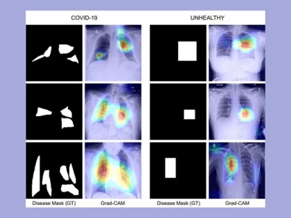 IIT Jodhpur researchers develop COVID-19 diagnosis technique using chest X-ray images | IIT Jodhpur researchers develop COVID-19 diagnosis technique using chest X-ray images