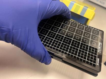 New placenta on a chip model to address preeclampsia in pregnancy | New placenta on a chip model to address preeclampsia in pregnancy New placenta on a chip model to address preeclampsia in pregnancy | New placenta on a chip model to address preeclampsia in pregnancy