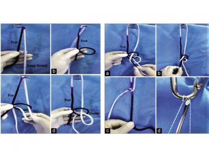 Doctor at Sakra World Hospital invents a new form of Arthroscopy knot - The Banarji's Knot | Doctor at Sakra World Hospital invents a new form of Arthroscopy knot - The Banarji's Knot