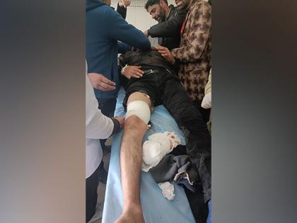 J-K: Bank employee shot at by terrorists in Pulwama | J-K: Bank employee shot at by terrorists in Pulwama