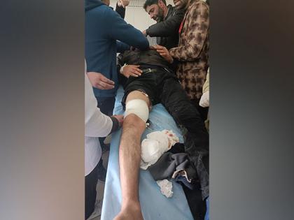 J-K: Bank employee shot at by terrorists in Pulwama | J-K: Bank employee shot at by terrorists in Pulwama J-K: Bank employee shot at by terrorists in Pulwama | J-K: Bank employee shot at by terrorists in Pulwama
