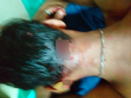 Mumbai: Man injured in leopard attack hospitalised | Mumbai: Man injured in leopard attack hospitalised