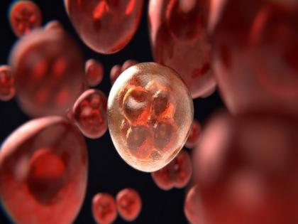 Combination therapy to improve survival outcomes in certain patients with acute myeloid leukemia: Study | Combination therapy to improve survival outcomes in certain patients with acute myeloid leukemia: Study