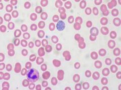 Protein tells developing cells to stick together | Protein tells developing cells to stick together Protein tells developing cells to stick together | Protein tells developing cells to stick together