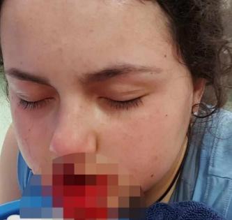 12-year-old girl horrifically mauled by pet dog in Australia | 12-year-old girl horrifically mauled by pet dog in Australia 12-year-old girl horrifically mauled by pet dog in Australia | 12-year-old girl horrifically mauled by pet dog in Australia
