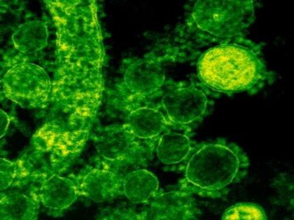 Study finds gut microbiota may change response to cancer treatment | Study finds gut microbiota may change response to cancer treatment Study finds gut microbiota may change response to cancer treatment | Study finds gut microbiota may change response to cancer treatment