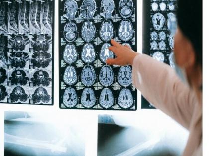 New study images ballistic wounds, bullet composition and implications for MRI safety | New study images ballistic wounds, bullet composition and implications for MRI safety