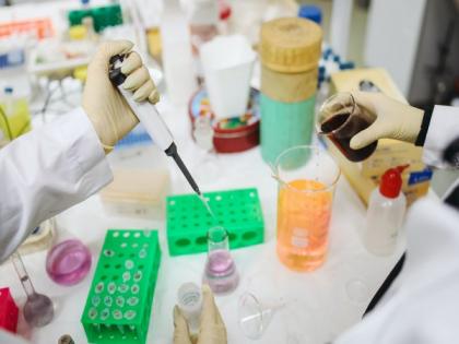 Study focuses on identification of SARS-CoV-2 virus features causing COVID-19 using primate model | Study focuses on identification of SARS-CoV-2 virus features causing COVID-19 using primate model Study focuses on identification of SARS-CoV-2 virus features causing COVID-19 using primate model | Study focuses on identification of SARS-CoV-2 virus features causing COVID-19 using primate model