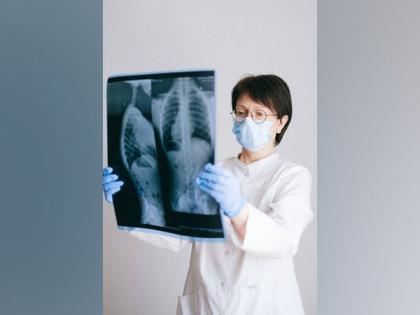 New therapies to reduce lung fibrosis developed | New therapies to reduce lung fibrosis developed