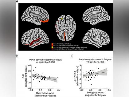 Study describes how COVID-19 damages the brain | Study describes how COVID-19 damages the brain