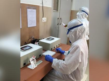 Mumbai sees highest number of COVID-19 cases today as 184 people test positive | Mumbai sees highest number of COVID-19 cases today as 184 people test positive Mumbai sees highest number of COVID-19 cases today as 184 people test positive | Mumbai sees highest number of COVID-19 cases today as 184 people test positive