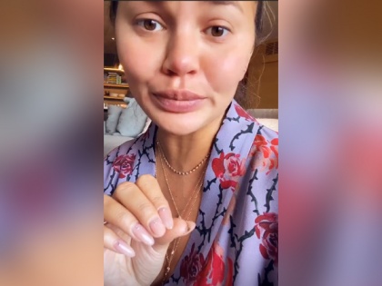 Pregnant Chrissy Teigen says she's been eating 'so much' sour candy that her 'tongue is falling off' | Pregnant Chrissy Teigen says she's been eating 'so much' sour candy that her 'tongue is falling off'