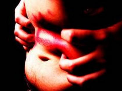 Researchers demonstrate new method to treat Crohn's disease | Researchers demonstrate new method to treat Crohn's disease Researchers demonstrate new method to treat Crohn's disease | Researchers demonstrate new method to treat Crohn's disease