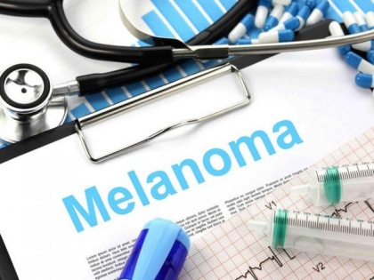 Antibiotics might help in treatment of melanoma | Antibiotics might help in treatment of melanoma