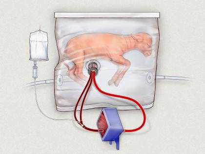 ‘Artificial wombs’ may soon see human trials: Report | ‘Artificial wombs’ may soon see human trials: Report ‘Artificial wombs’ may soon see human trials: Report | ‘Artificial wombs’ may soon see human trials: Report