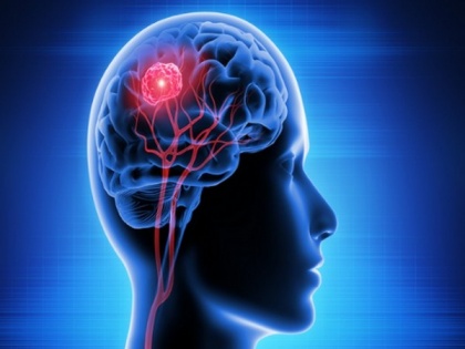 Study provides new insight into brain complexity | Study provides new insight into brain complexity