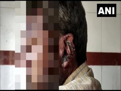 MP: Man brutally thrashed for being unable to return money, public thrashing video goes viral | MP: Man brutally thrashed for being unable to return money, public thrashing video goes viral