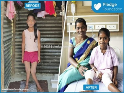 Pledge Foundation's Emergency Medical Care Project saved life of 12-year-old Rupali | Pledge Foundation's Emergency Medical Care Project saved life of 12-year-old Rupali