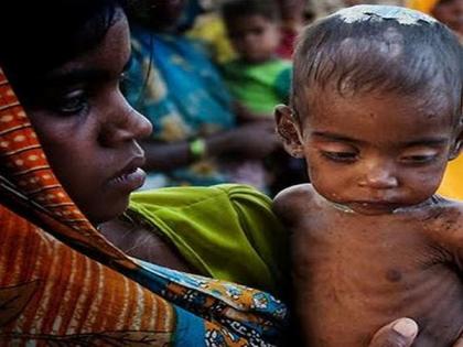 Heightened need for CMAM to reverse rising incidence of Severe Acute Malnutrition (SAM) | Heightened need for CMAM to reverse rising incidence of Severe Acute Malnutrition (SAM)