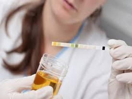 Urine test reveals quality of your diet and whether it's the best fit for your body :Study | Urine test reveals quality of your diet and whether it's the best fit for your body :Study
