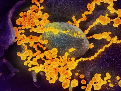 Netherlands confirms first case of coronavirus | Netherlands confirms first case of coronavirus