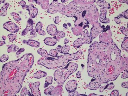 Researchers identify process vital to placenta growth in early pregnancy | Researchers identify process vital to placenta growth in early pregnancy Researchers identify process vital to placenta growth in early pregnancy | Researchers identify process vital to placenta growth in early pregnancy