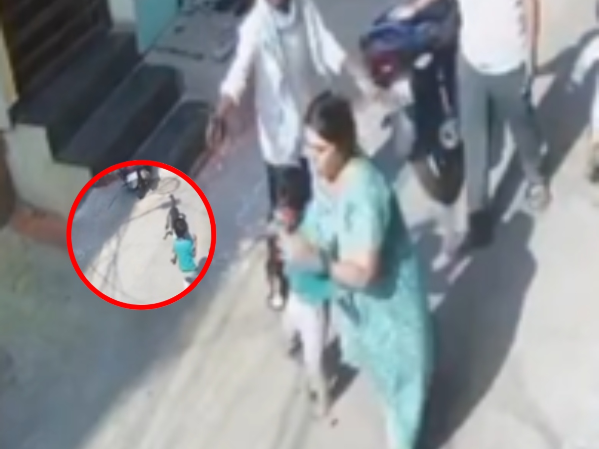 Hyderabad Shocker: Stray Dog Attack Leaves 5-Year-old Seriously Injured ...