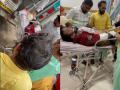 Pune Youth Suffers Severe Burns After High-Voltage Line Falls in Ravet; MSEDCL Officials Booked for Negligence - Hindi News | Pune Youth Suffers Severe Burns After High-Voltage Line Falls in Ravet; MSEDCL Officials Booked for Negligence | Latest pune News at Lokmattimes.com