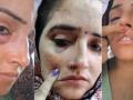 Seema Haider Beaten by Husband Sachin? Shocking Video of Pakistani Woman Showing Injury Marks Sparks Controversy - Hindi News | Seema Haider Beaten by Husband Sachin? Shocking Video of Pakistani Woman Showing Injury Marks Sparks Controversy | Latest national News at Lokmattimes.com
