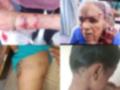 Dog Attack in Pune: Young Boy and 88-Year-Old Woman Seriously Injured in Separate Incidents - Hindi News | Dog Attack in Pune: Young Boy and 88-Year-Old Woman Seriously Injured in Separate Incidents | Latest pune News at Lokmattimes.com