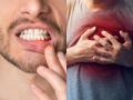 How Poor Oral Hygiene May Trigger a Heart Attack; Expert Explains the Hidden Risk - Hindi News | How Poor Oral Hygiene May Trigger a Heart Attack; Expert Explains the Hidden Risk | Latest health News at Lokmattimes.com