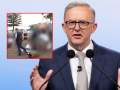 Sydney Mass Shooting: Australian PM Albanese Calls Bondi Attack Shocking as 10 Killed, 16 Injured - Hindi News | Sydney Mass Shooting: Australian PM Albanese Calls Bondi Attack Shocking as 10 Killed, 16 Injured | Latest international News at Lokmattimes.com