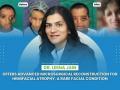 Dr. Leena Jain Offers Advanced Microsurgical Reconstruction for Hemifacial Atrophy, a Rare Facial Condition - Hindi News | Dr. Leena Jain Offers Advanced Microsurgical Reconstruction for Hemifacial Atrophy, a Rare Facial Condition | Latest health News at Lokmattimes.com
